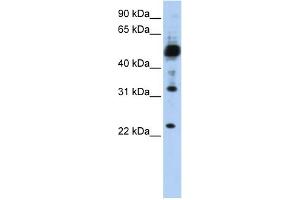WB Suggested Anti-TMEM38B Antibody Titration:  0.