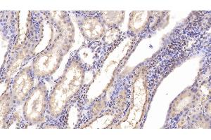 Detection of CHEM in Human Kidney Tissue using Monoclonal Antibody to Chemerin (CHEM) (Chemerin antibody  (AA 33-158))