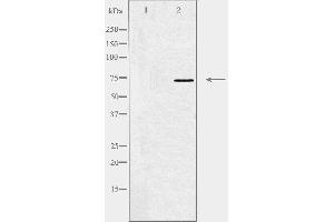 Western blot analysis of extracts from HT-29 cells, using MED17 antibody.