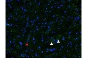 Expression of μ-opioid receptor (MOR-1) in rat spinal cord - Immunohistochemical staining of rat spinal cord frozen section using Anti-μ-Opioid Receptor (OPRM1) (extracellular) Antibody (ABIN7043403, ABIN7044887 and ABIN7044888), (1:100), followed by goat anti-rabbit AlexaFluor-488 secondary antibody (green). (Mu Opioid Receptor 1 antibody  (Extracellular, N-Term))