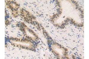 Immunohistochemistry (IHC) image for anti-High Mobility Group Nucleosomal Binding Domain 2 (HMGN2) (AA 2-81) antibody (ABIN7443026)