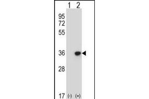 Western blot analysis of DLX4 (arrow) using rabbit polyclonal DLX4 Antibody (Center) (ABIN657967 and ABIN2846913). (DLX4 antibody  (AA 72-100))
