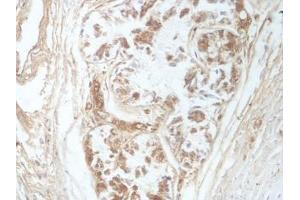 IHC analysis of formalin-fixed paraffin-embedded fetal bronchus, using SUN1 antibody (1/100 dilution). (SUN1 antibody  (AA 22-173))