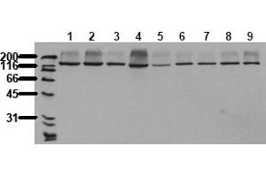 Western Blotting (WB) image for anti-RAPTOR (RAPTOR) antibody (ABIN492625)
