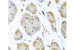Immunohistochemistry of paraffin-embedded Human stomach using MYLK Polyclonal Antibody at dilution of 1:100 (40x lens). (MYLK antibody)