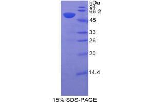 SDS-PAGE analysis of Pig HIF1a Protein. (HIF1A Protein)
