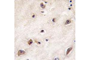 Image no. 2 for anti-Growth Differentiation Factor 1 (GDF1) (N-Term) antibody (ABIN357457)