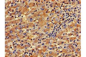 Immunohistochemistry (IHC) image for anti-Platelet/endothelial Cell Adhesion Molecule (PECAM1) (AA 525-586) antibody (ABIN7163576)