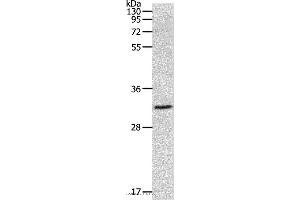 Western blot analysis of 293T cell, using MMP26 Polyclonal Antibody at dilution of 1:500 (MMP26 antibody)