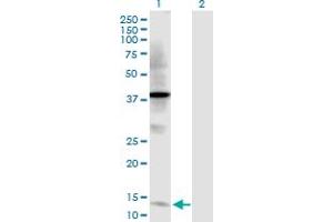 Western Blot analysis of TFF2 expression in transfected 293T cell line by TFF2 MaxPab polyclonal antibody. (Trefoil Factor 2 antibody  (AA 1-129))