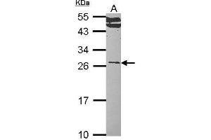 WB Image Sample (30 ug of whole cell lysate) A: Hep G2 , 12% SDS PAGE RALA antibody antibody diluted at 1:1000 (rala antibody  (Center))