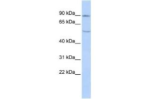 Western Blotting (WB) image for anti-Cadherin 4 (CDH4) antibody (ABIN2458919)