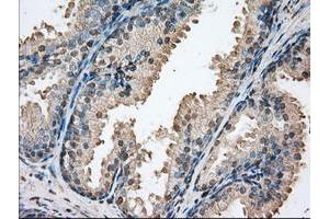 Image no. 1 for anti-Proto-Oncogene Pim-2 (Serine Threonine Kinase) (PIM2) antibody (ABIN1500220) (PIM2 antibody)