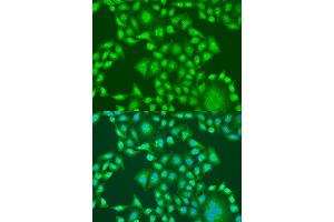 Immunofluorescence analysis of U2OS cells using PTEN antibody. (PTEN antibody  (AA 209-403))