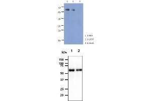 The cell lysate of HeLa (40ug) were resolved by SDS-PAGE, transferred to PVDF membrane and probed with anti-human PARP2 antibody (1:500 ~ 1:5000). (PARP2 antibody)
