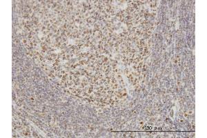 Immunoperoxidase of monoclonal antibody to EPSTI1 on formalin-fixed paraffin-embedded human tonsil. (EPSTI1 antibody  (AA 1-100))