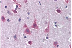 anti-MTO1 (C-Term) antibody