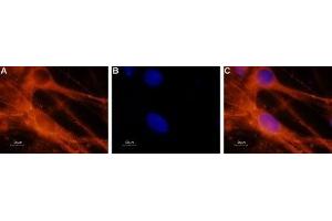 Expression of NaV1. (SCN8A antibody  (Intracellular))