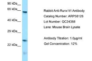 Western Blotting (WB) image for anti-Runt-Related Transcription Factor 1, Translocated To, 1 (Cyclin D-Related) (RUNX1T1) (N-Term) antibody (ABIN971644) (RUNX1T1 antibody  (N-Term))