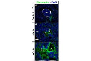 Immunohistochemical assessment of proteins involved in blood coagulation in ob/ob pancreata. (Fibronectin antibody)