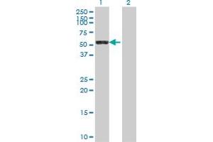 Western Blot analysis of LAP3 expression in transfected 293T cell line by LAP3 polyclonal antibody (A01). (LAP3 antibody  (AA 420-519))