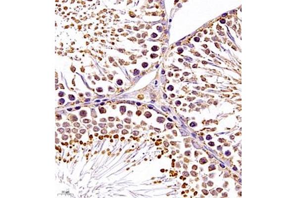 SRP14 antibody