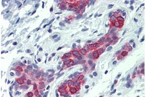 Immunohistochemistry (Formalin-fixed Paraffin-embedded Sections) (IHC (fp)) image for anti-BCL2-Antagonist/killer 1 (BAK1) (AA 1-14) antibody (ABIN573998)