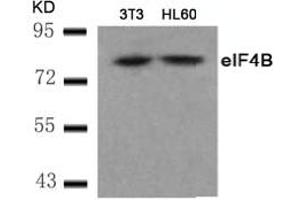 Image no. 2 for anti-Eukaryotic Translation Initiation Factor 4B (EIF4B) (AA 420-424) antibody (ABIN401568)