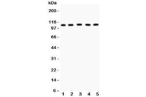 Western blot testing of MSH2 antibody and Lane 1:  mouse testis;  2: (m) skeletal muscle;  3: human HeLa;  4: (h) A549;  5: (h) SMMC-7721 lysate. (MSH2 antibody  (AA 337-583))