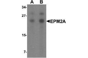 Western blot analysis of SW480 in SW480 cell lysate with EPM2A Antibody  at (A) 1 and (B) 2 μg/ml.