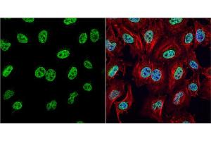Immunofluorescence (IF) image for anti-High Mobility Group Box 1 (HMGB1) antibody (ABIN2854997)