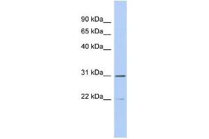 Western Blotting (WB) image for anti-Zinc Finger, C3HC-Type Containing 13 (ZCCHC13) (Middle Region) antibody (ABIN2786448)