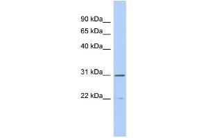 WB Suggested Anti-ZCCHC13 Antibody Titration: 0. (ZCCHC13 antibody  (Middle Region))