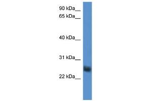WB Suggested Anti-SLA2 Antibody Titration: 0. (SLAP2 antibody  (Middle Region))