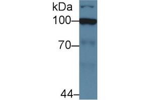 Western Blot; Sample: Human Jurkat cell lysate; Primary Ab: 5µg/ml Rabbit Anti-Human HK2 Antibody Second Ab: 0. (Hexokinase 2 antibody  (AA 469-669))