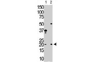 The HPCA polyclonal antibody  is used in Western blot to detect HPCA in Y79 cell lysate (Lane 1) and mouse brain tissue lysate (Lane 2) . (Hippocalcin antibody  (N-Term))