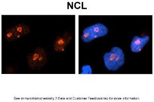 Sample Type: NT2 cells Red: Antibody Blue: DAPI Primary Dilution: 1ug/50ul antibody Secondary Antibody: Alexa goat anti-rabbit 594 Image Submitted by: Yuzhi Chen, University of Arkansas for Medical Sciences (Nucleolin antibody  (C-Term))