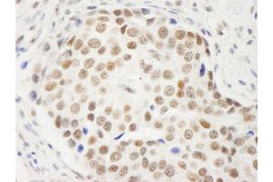 Immunohistochemistry (IHC) image for anti-Symplekin (SYMPK) (AA 1224-1274) antibody (ABIN7453798)