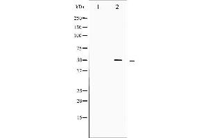 Western blot analysis of SRF phosphorylation expression in Serum treated LOVO whole cell lysates,The lane on the left is treated with the antigen-specific peptide. (SRF antibody  (pSer99))