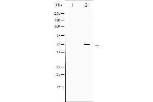 Western blot analysis of SRF phosphorylation expression in Serum treated LOVO whole cell lysates,The lane on the left is treated with the antigen-specific peptide.