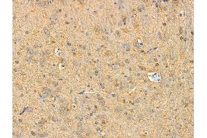 ABIN7093276 and ABIN7097295 at 1/100 staining Rat brain tissue by IHC-P. (tau antibody  (pSer202, pSer519))