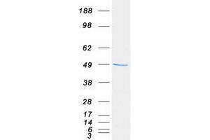 Validation with Western Blot
