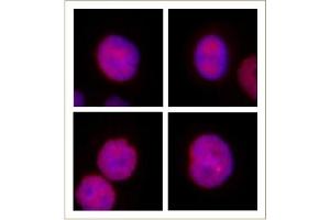 JMJD2B / KDM4B antibody (pAb) tested by Immunofluorescence. (KDM4B antibody  (C-Term))