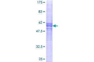 Image no. 1 for Von Willebrand Factor (VWF) (AA 1-273) protein (GST tag) (ABIN1325139) (VWF Protein (AA 1-273) (GST tag))