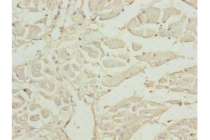 Immunohistochemistry of paraffin-embedded human heart tissue using ABIN7143358 at dilution of 1:100