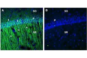 Expression of EphA2 in rat hippocampus. (EPH Receptor A2 antibody  (Extracellular, N-Term))