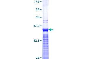 Image no. 1 for Antigen Identified By Monoclonal Antibody Ki-67 (MKI67) (AA 3157-3256) protein (GST tag) (ABIN1310965) (Ki-67 Protein (AA 3157-3256) (GST tag))