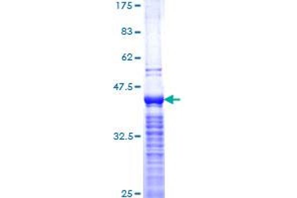 Ki-67 Protein (AA 3157-3256) (GST tag)