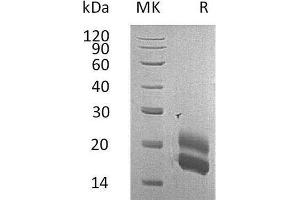 Western Blotting (WB) image for Colony Stimulating Factor 2 (Granulocyte-Macrophage) (CSF2) protein (His tag) (ABIN7321257) (GM-CSF Protein (His tag))