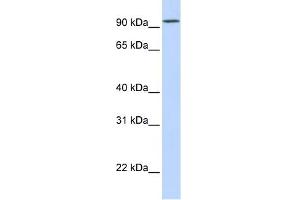 DPP6 antibody used at 1 ug/ml to detect target protein. (DPP6 antibody  (Middle Region))